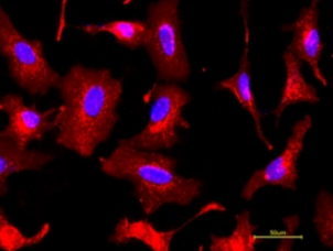 FITC-WFAɹؘ(bio)ӛأWFAWFLF(xin)luorescein labeled Wisteria Floribunda Lectin (WFA, WFL)